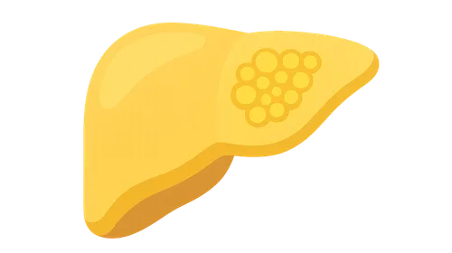 GSD type VI (Hers disease)