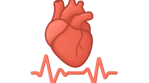 Common arrhythmia recognition