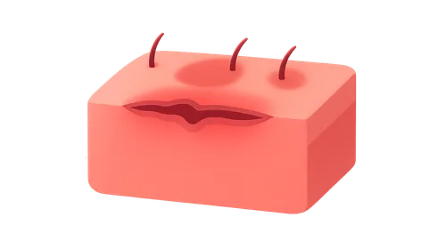 Factors affecting wound healing