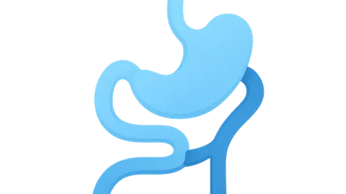 Biliopancreatic Diversion