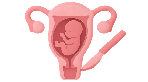 Surgery During Pregnancy