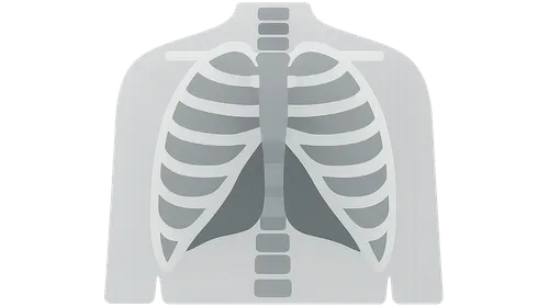 Radiographic Anatomy of Chest