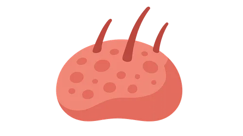 Cellular components of inflammation