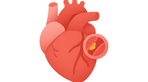 Coronary Artery Disease and Angina
