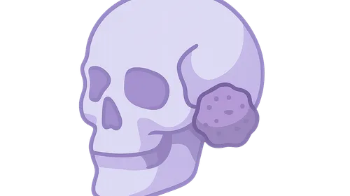 Meningiomas of the Skull Base