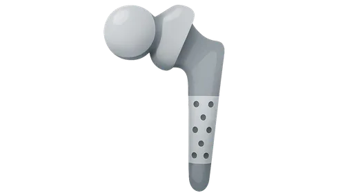 Revision Arthroplasty