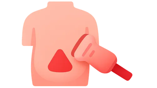 Diagnostic approach to acute abdomen