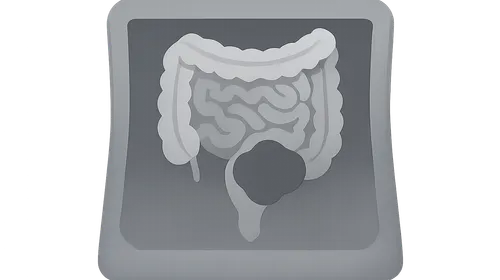 Acute Abdomen Imaging