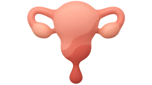 Postpartum hemorrhage