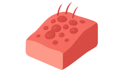 Autoinflammatory Syndromes