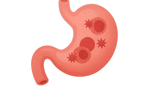 Immune-related adverse events