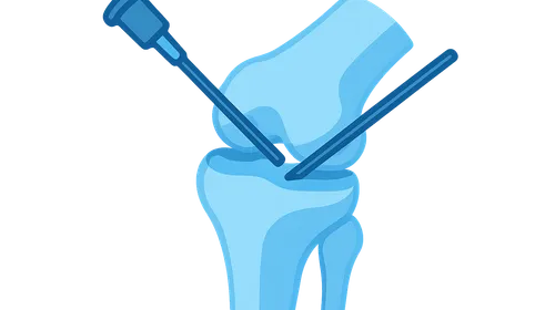 Arthroscopic procedures overview