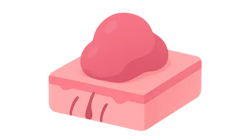 Dermal tumors and proliferations