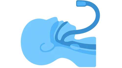 Fiberoptic Intubation