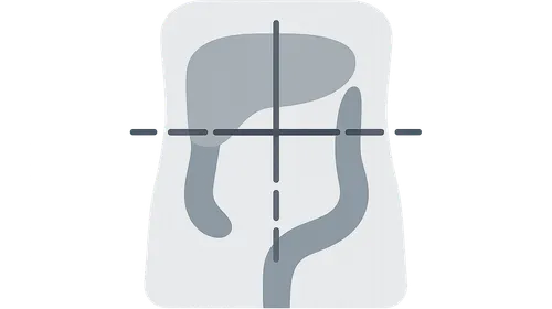Abdominal radiologic landmarks