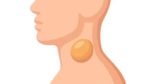 Neck Masses: Differential Diagnosis