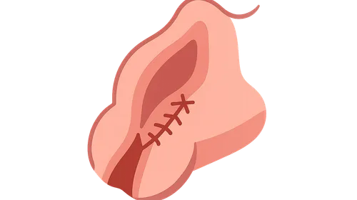 Genital tract trauma repair