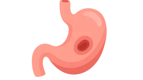 Peptic Ulcer Disease