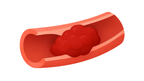 Thromboembolic disease