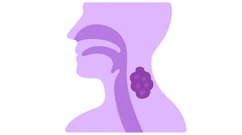 Staging of Head and Neck Cancer