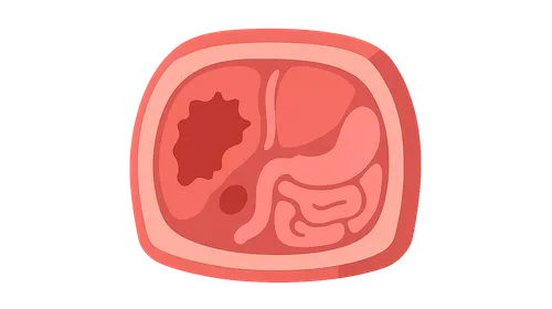 Abdominal Trauma Imaging