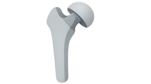 Imaging of Prostheses and Implants