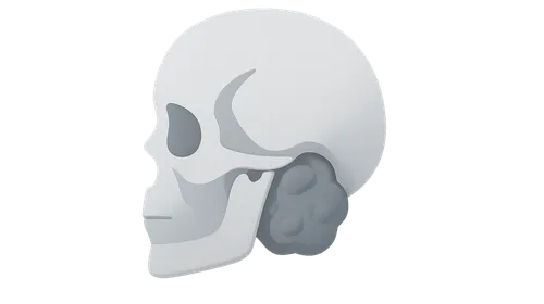 Skull Base Chordomas and Chondrosarcomas