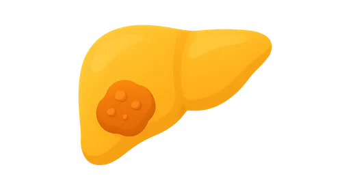 Liver Tumors