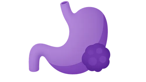 Principles of Surgical Oncology