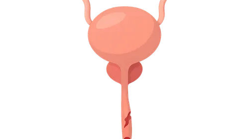 Urethral injury management