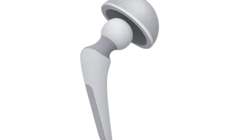 Implant Materials and Design