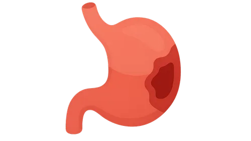 Abdominal emergencies