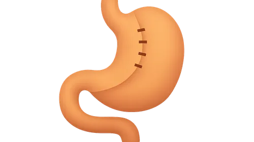 Bariatric Surgery Principles