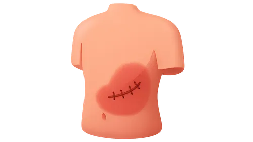 Postoperative Complications Detection