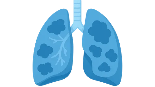 Occupational Lung Diseases