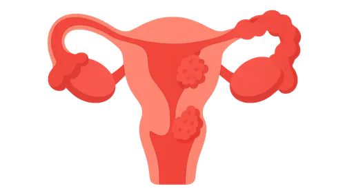 Pelvic Inflammatory Disease