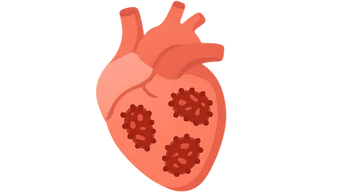 Infectious diseases (sepsis, endocarditis)