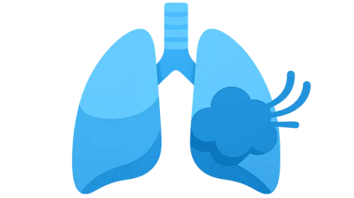 Asthma management and exacerbations
