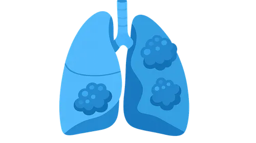 COPD pathophysiology and diagnosis