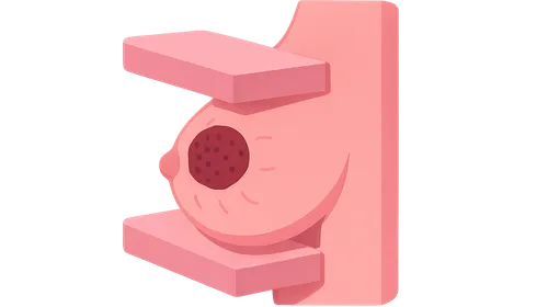 Breast Cancer Screening