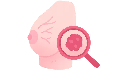 Breast Cancer: Diagnosis and Staging