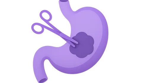 Surgical Oncology Principles