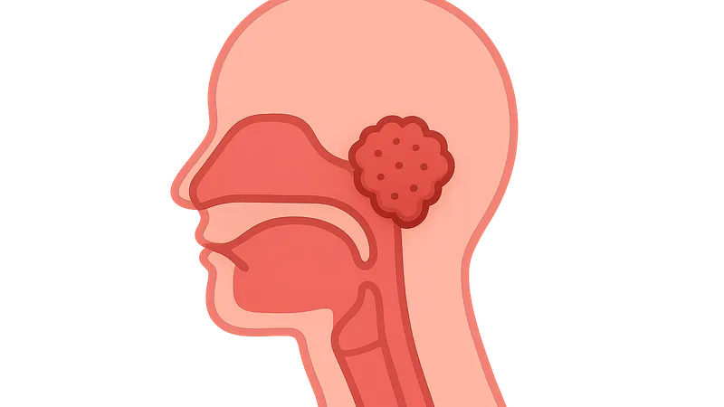 Nasopharyngeal Carcinoma