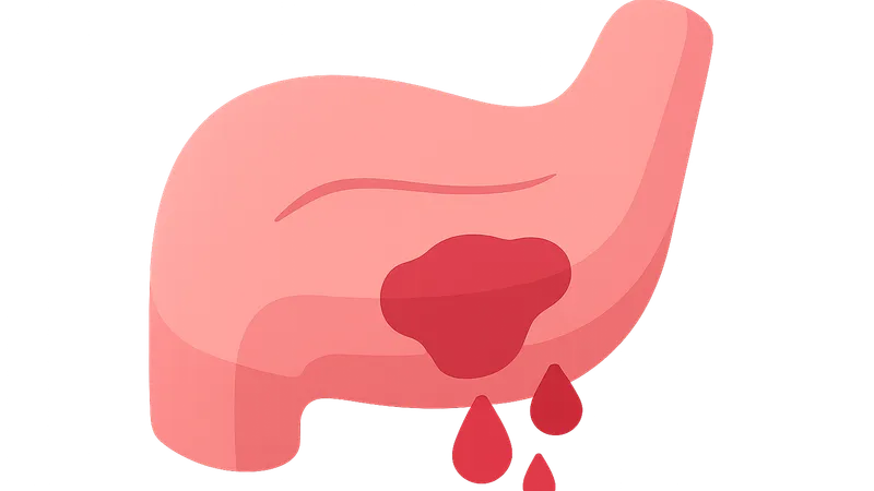 Postoperative bleeding — MCQs