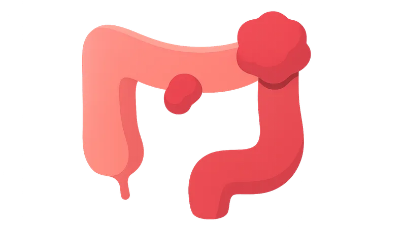 Colon polyps and neoplasms