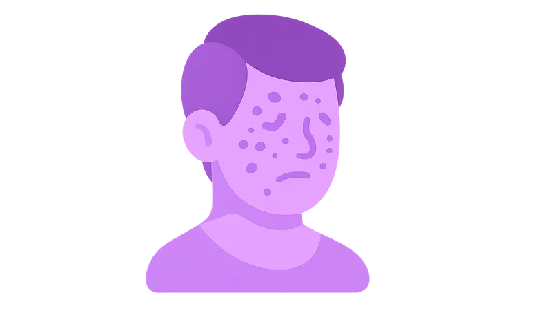 Systemic lupus erythematosus