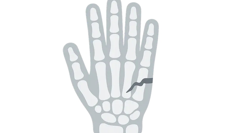 Hand Fractures and Dislocations