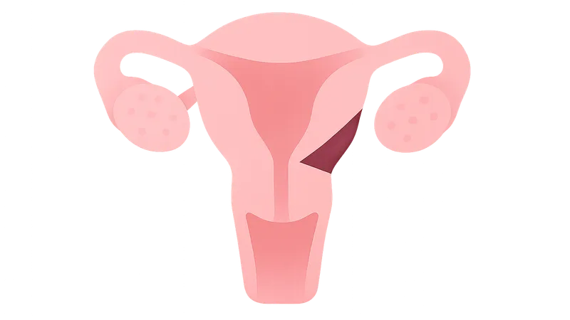 Fertility-preserving surgical techniques