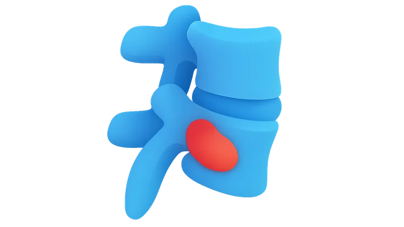Spondyloarthropathies