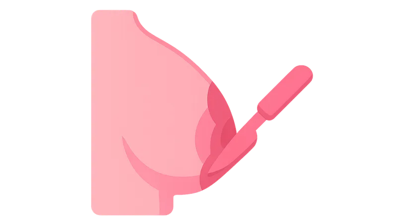 Surgical Management of Breast Cancer